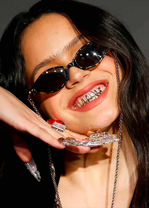 Grillz dental o joyas dentales: una moda peligrosa para tu boca